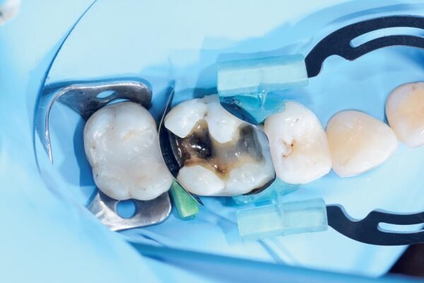 myTines GO 6paari - Image 2
