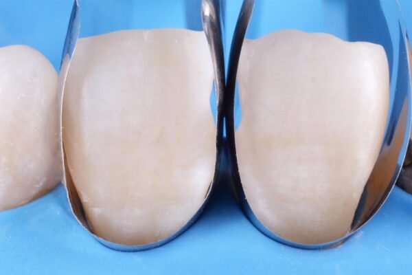Unica anterior Introkit - Image 3