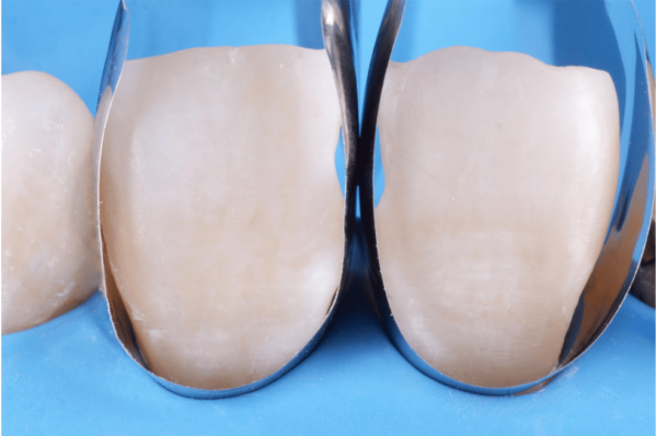 Unica anterior matriitsid - Image 2
