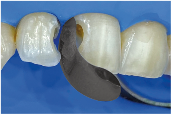 QuickmatFLEX neerumatriitsid - Image 2